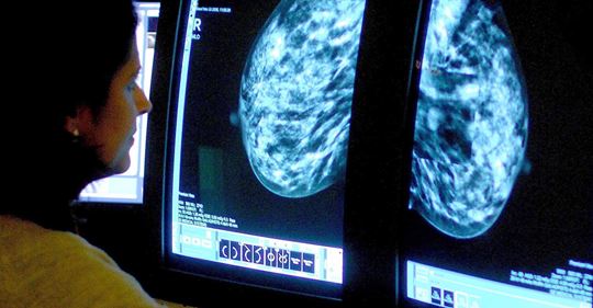 Antibody Discovery Offers Breakthrough In Breast Cancer Fight - Breast ...